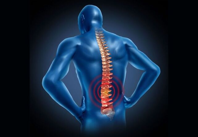 Lomber omurganın osteokondrozu çoğu insanda görülen bir hastalıktır. 