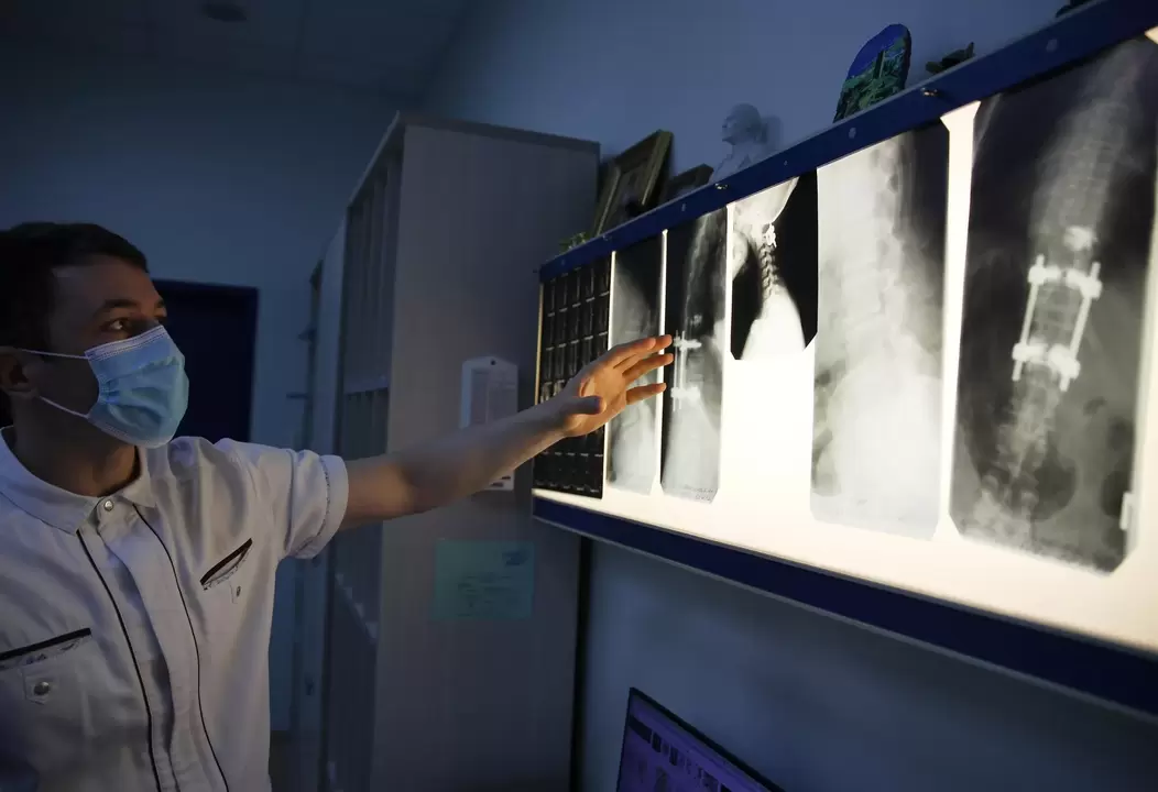Doktorlar radyografi gibi enstrümantal yöntemleri kullanarak servikal osteokondrozu teşhis eder
